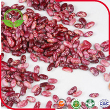 Red Speckled Kidney Beans Big and Small Size